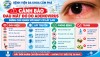 Cảnh báo: Bệnh đau mắt đỏ do ADENOVIRUS - Đừng chủ quan với nguy cơ lây lan thành dịch!
